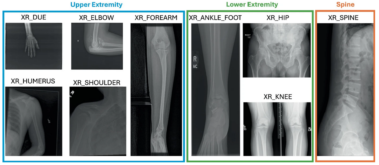 AI-Based Musculoskeletal Radiograph Registry
