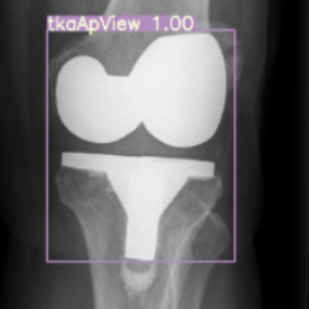 Give Me a Knee Radiograph, I Will Tell You Where the Knee Joint Area Is